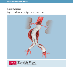 Leczenie tętniaka aorty brzusznej