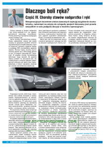 Ból ręki – Dlaczego boli ręka? Choroby stawów nadgarstka i ręki