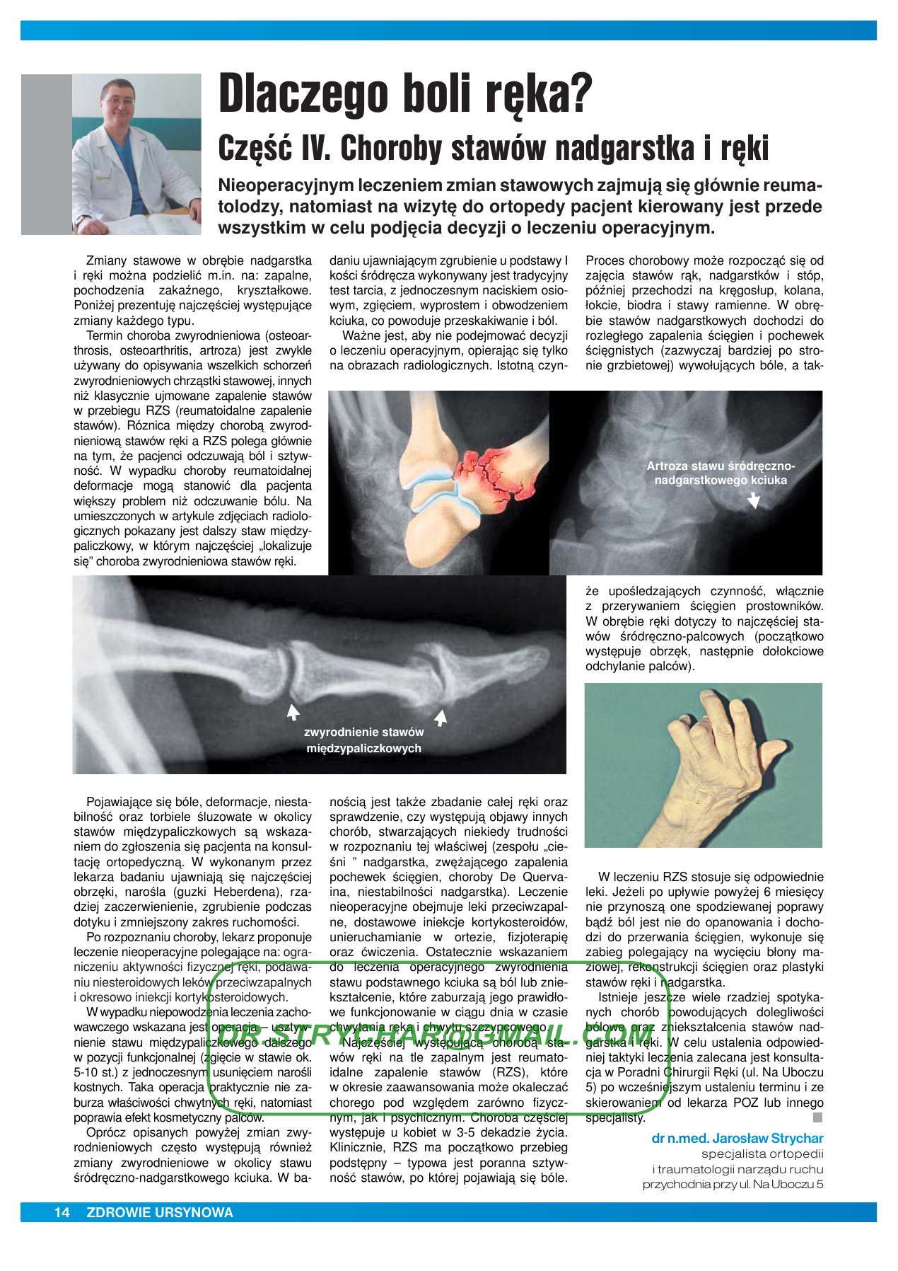 artroza codului de diagnostic al genunchiului articulațiile doare cum să trateze un umăr