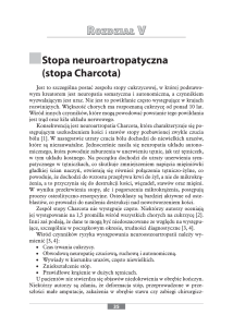 Stopa neuroartropatyczna (stopa Charcota)