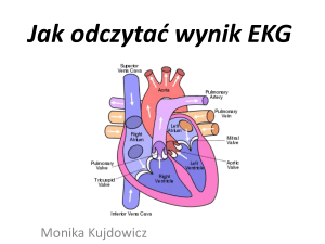 Jak odczyta* wynik EKG