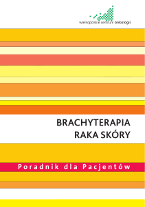 brachyterapia raka skóry - Wielkopolskie Centrum Onkologii